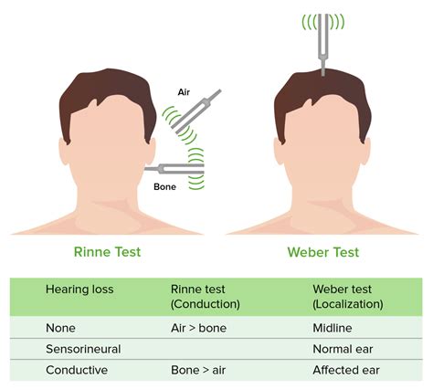 scratch test ear|How Reliable Is the “Scratch Test” Versus the Weber Test Aft .